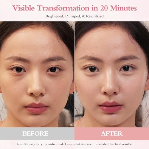 PDRN Under Eye Patches For Puffy Eyes And Dark Circles