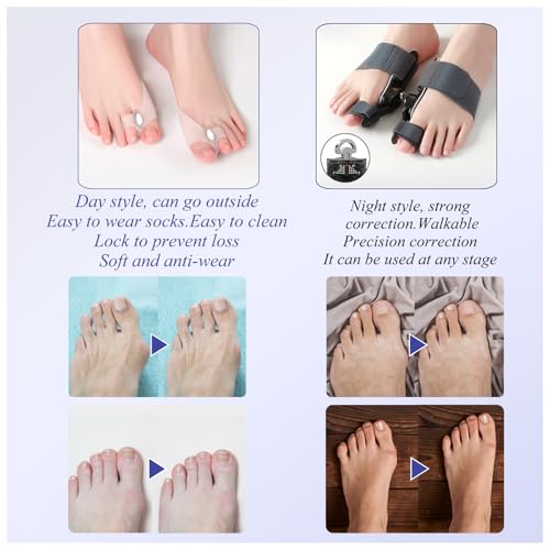 HEWAOMM Bunion Corrector Set For Women Men