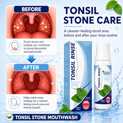 Tonsil Stone Mouthwash Or Oral Rinse